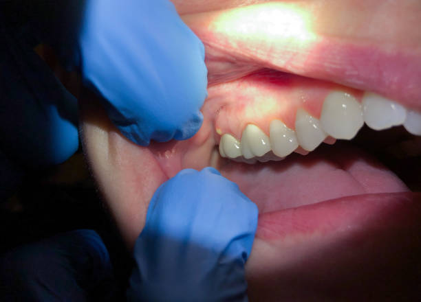 Best Emergency Gum Pain Relief  in Trent Woods, NC